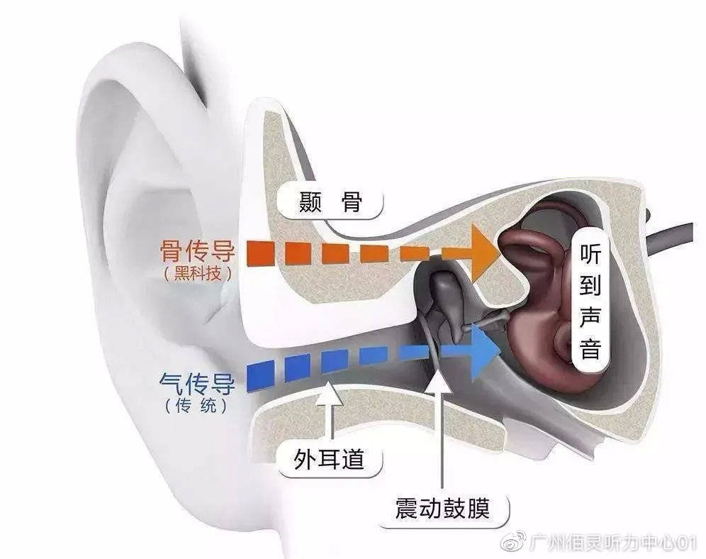 美国耳蜗最新潮流听力科技革新亮相，引领全球听力革新潮流